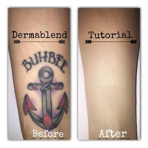 Dermablend tatoo cover up