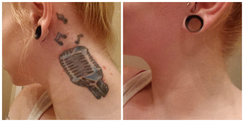 Tattoo Camo before and after